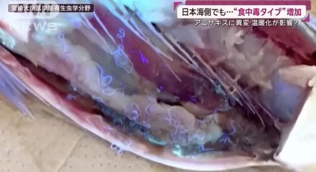 【悲報】アニキサス、福岡でも激烈猛威「死ぬかと思った」