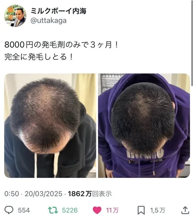 【画像】ミルクボーイ内海　頭髪が完全復活