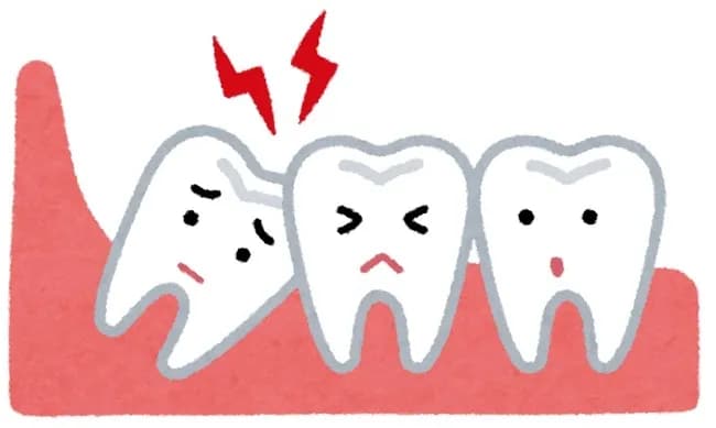🦷「親知らず」抜いたことあるニキおる？