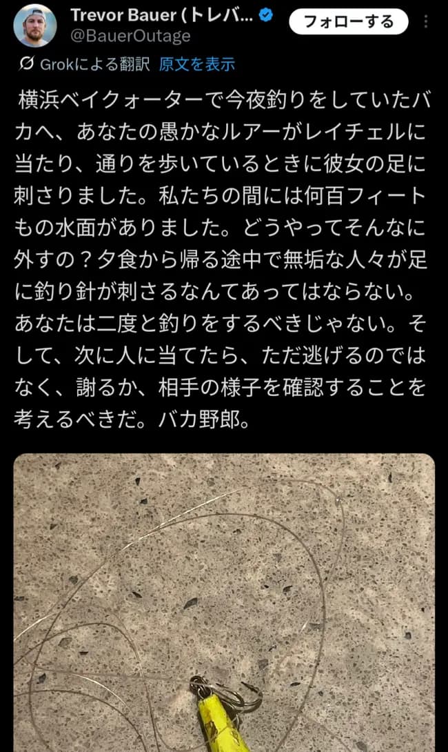 バウアー、ブチ切れ