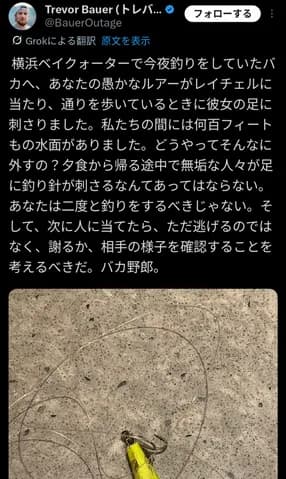 【悲報】バウアー、代理人・レイチェルさんの足にルアーが刺さりブチギレ