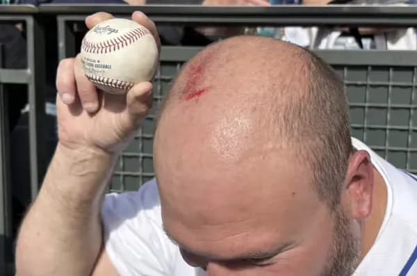 大谷の55号HR球をキャッチした男性、手すりに頭頂部をぶつけて出血