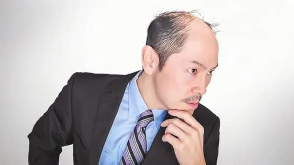 【悲報】男性ホルモン「筋肉つきます。体毛濃くなります」←まぁわかる「ハゲます」←これｗｗｗｗｗｗｗｗｗｗｗｗｗｗｗｗ