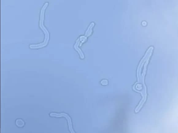 【画像】　目閉じたら"コレ"見えるのなんでなんｗｗｗｗｗｗ