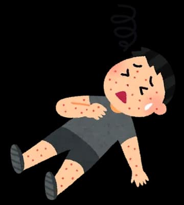 友達にふざけてアレルギーの食べ物混ぜて出したら死にかけてて草