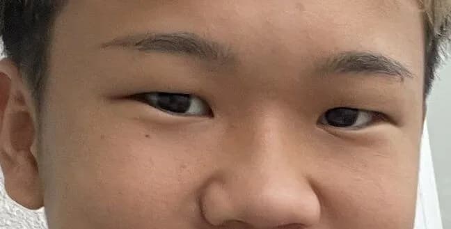 【悲報】ゆたぼん、事故の治療費をネットで乞食して整形代に使ってる疑惑浮上ｗｗｗｗｗｗ