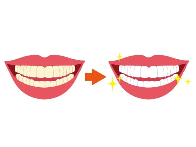 歯石って溜まると支障あるの？