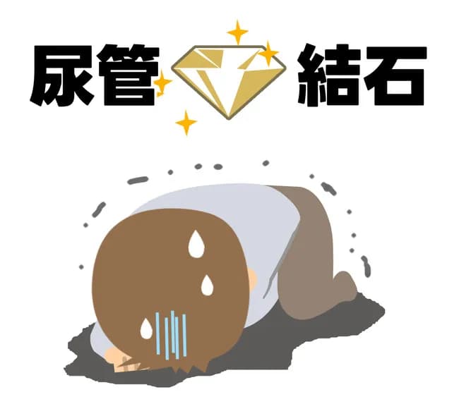 【悲報】尿管結石とかいう痛すぎる病