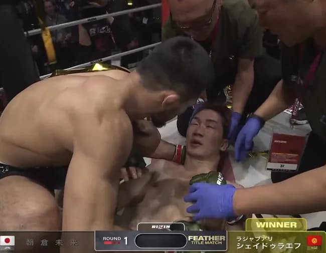 【悲報】朝倉未来「33回も殴られて意識飛びそうになった。まじやばかった終わった後も脳ミソやばい」