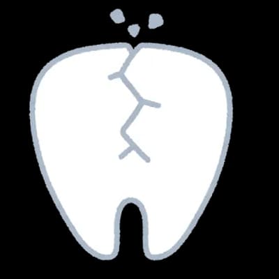 奥歯欠けるじゃん？欠けた歯ってどこ行ったんだ？