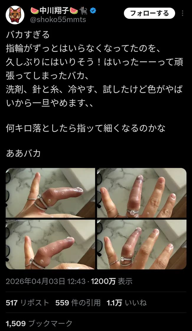 【速報】中川翔子、わりとピンチ