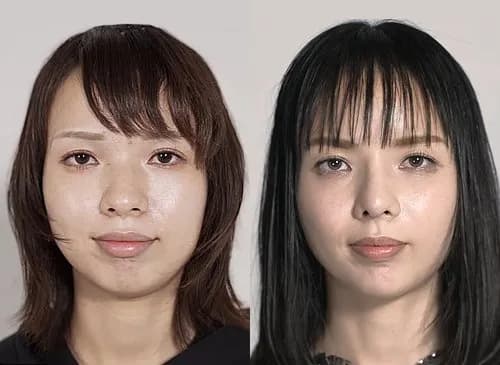 【悲報】顔面整形に5000万円つぎ込んだ美容外科医さんの「無加工ショット」がヤバすぎるｗｗｗｗｗｗｗｗｗｗ
