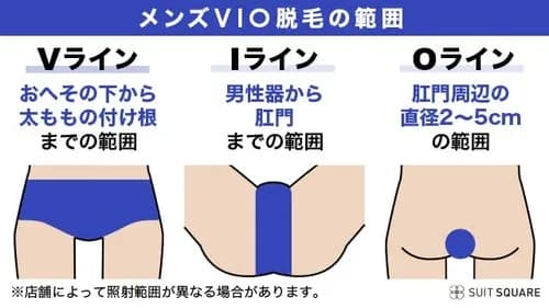 【悲報】VIO脱毛、ガチでエッッッすぎるwwwwwwwwww