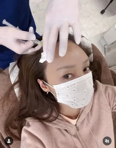 【悲報】神田うのさん、薄毛治療でAGAクリニックに通い始めてしまうｗｗｗｗｗｗｗｗｗｗ
