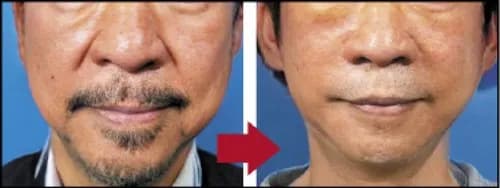 【悲報】初めて性行為を経験した年齢がその後の老化に影響する可能性があるとの研究結果が発表されるｗｗｗｗｗｗｗｗｗｗ