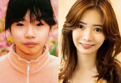【悲報】カリカリ女さん、見た目エイリアンなのに大金払って整形してしまうｗｗｗｗｗｗｗｗｗｗ