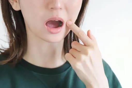 【急募】親知らずを抜くんやが痛いんか?wwwwwwwwwwwwwwww