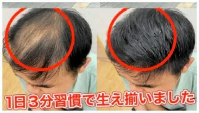 育毛剤広告に措置命令 使用前後の比較画像は〝加工〟によるもの