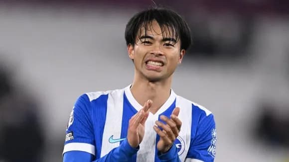 【画像】最新の三笘さん、やっぱりハゲてたwwwwww