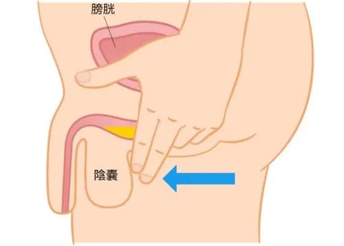 【悲報】小便終えてパンツの中に引っ込めたら途端に再排出が始まる奴wwwwwwwwww