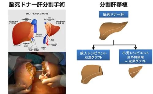 【狂気】人類さん、ついに気づいてしまう「遺伝子操作で頭のない人体を量産して臓器取り出せばよくね?」wwwwwwwwww